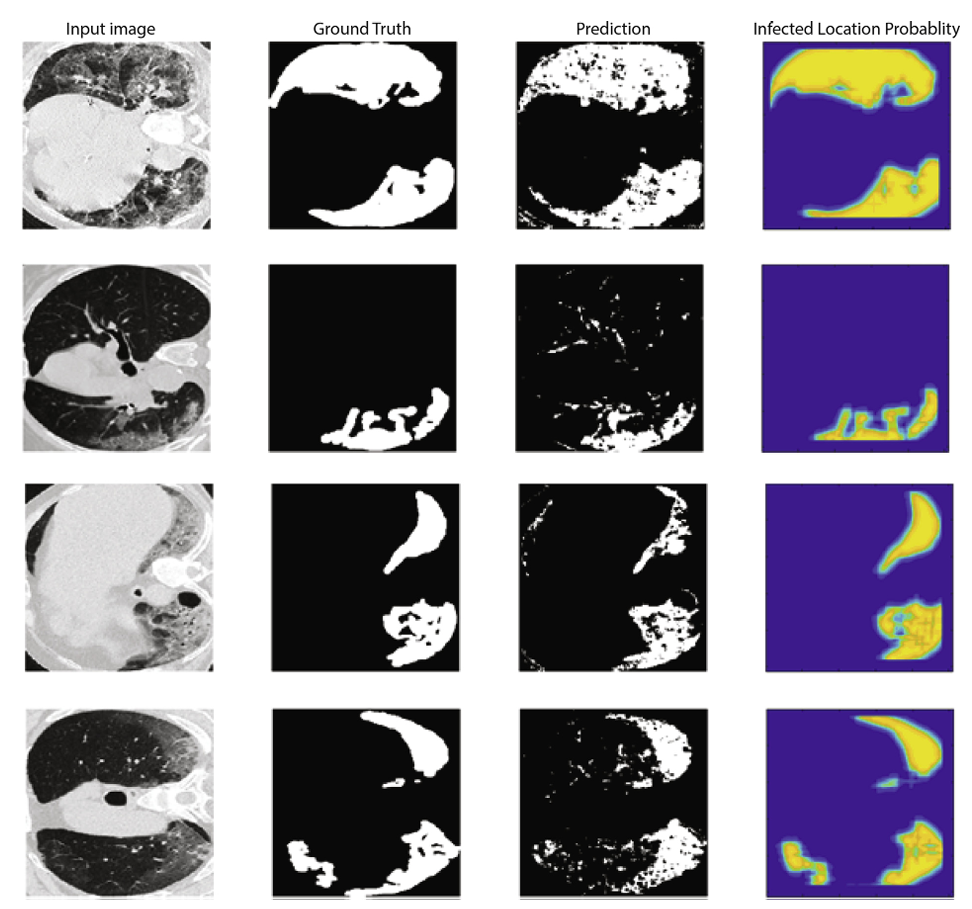 COVID-19 lung imaging ground truth, prediction, and infection probability results