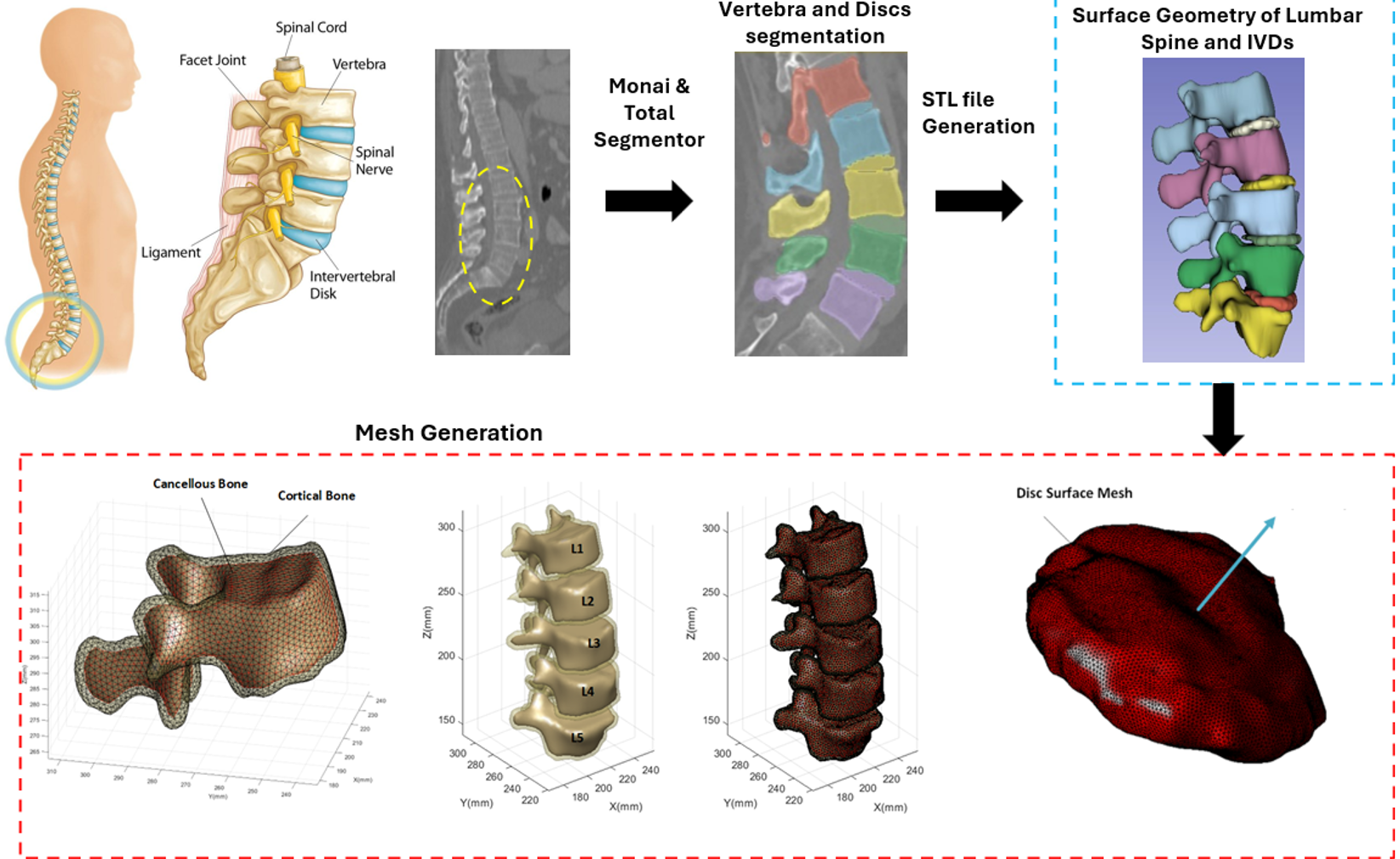 Patient-specific lumbar spine segmentation and finite element modeling workflow