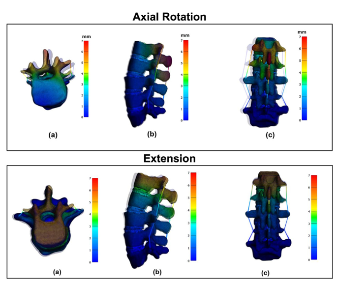 Automated lumbar spine finite element modeling and stress analysis