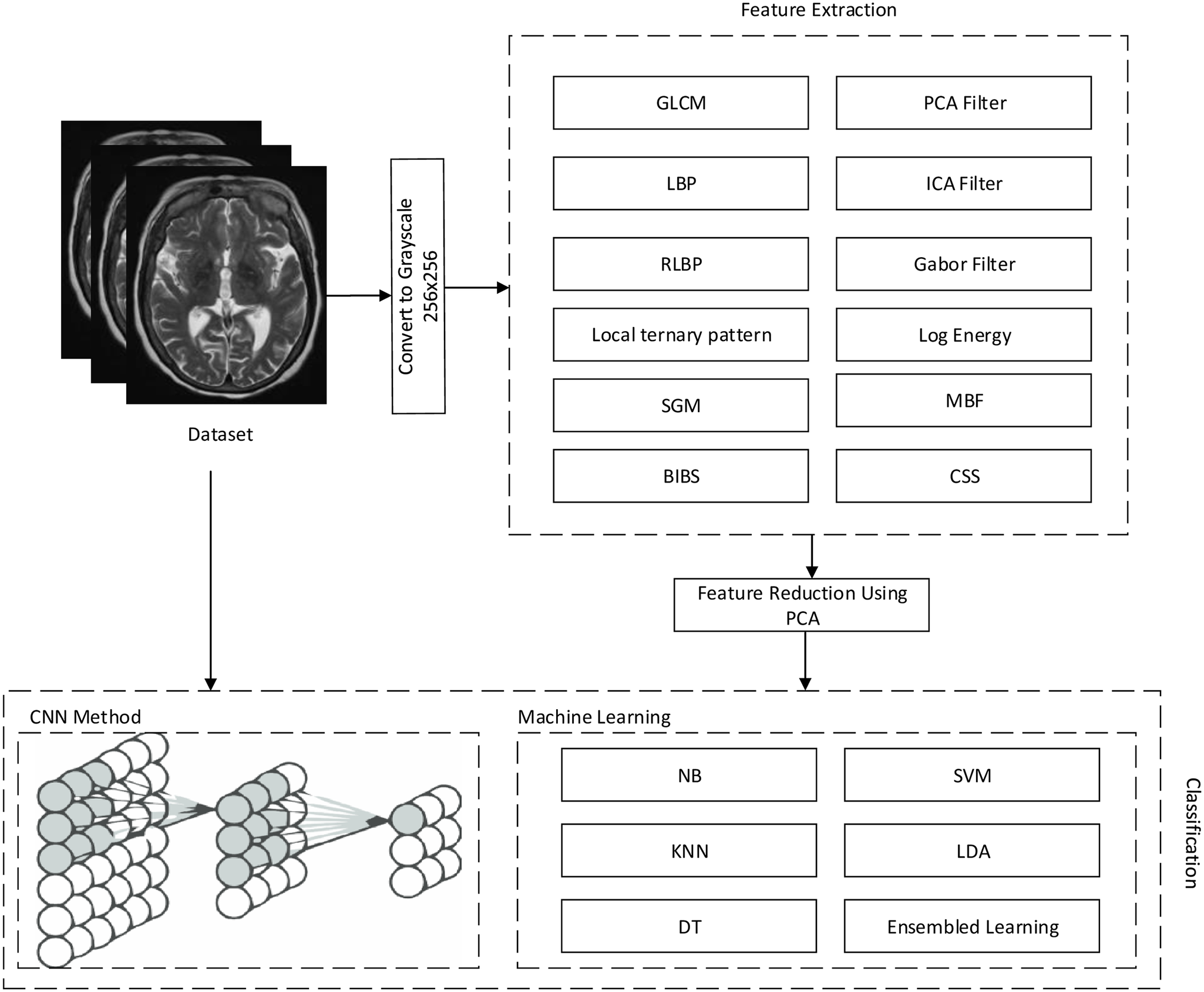 Alzheimer's severity classification overview