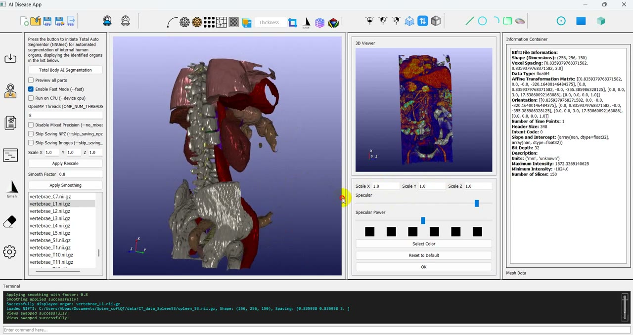 Patient-specific simulation model displayed in ParaView