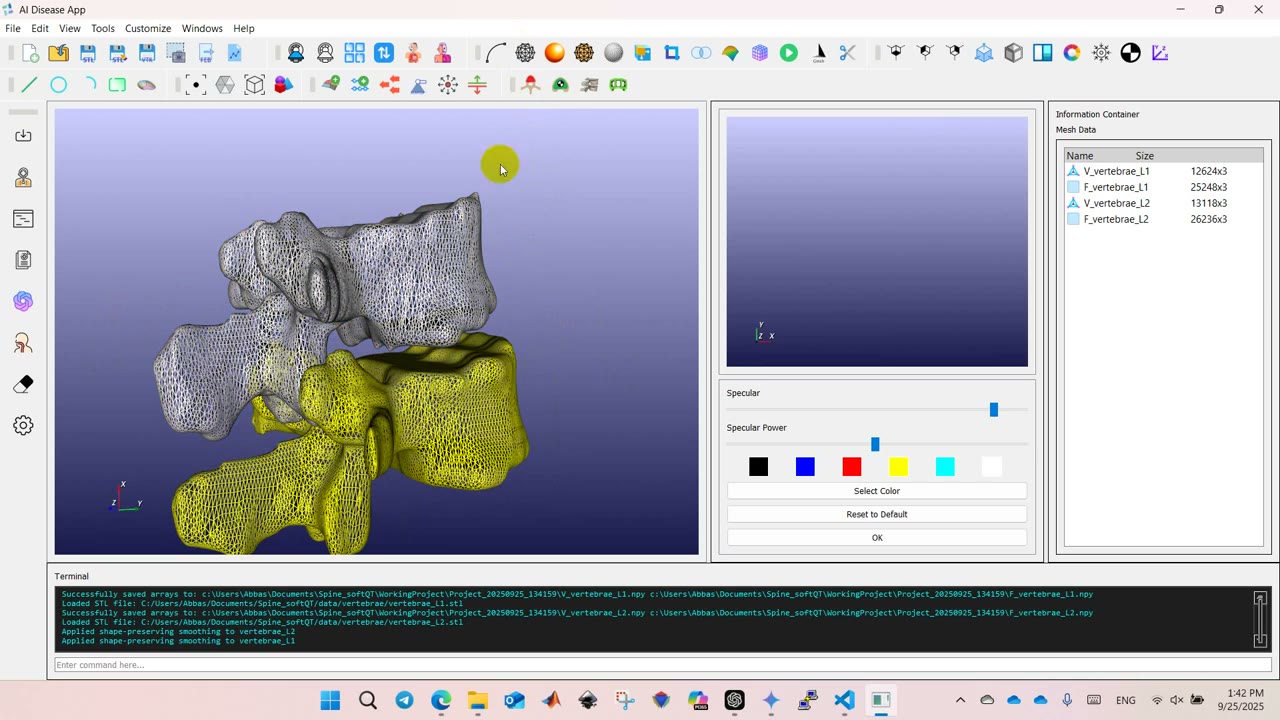 Inspection of aligned multilevel lumbar vertebral meshes