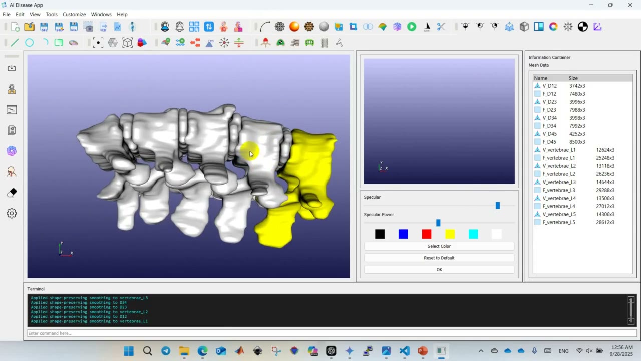 Complete patient-specific lumbar spine model workflow in the AI Disease App